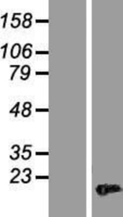Novus Biologicals™ HMGA2 Overexpression Lysate