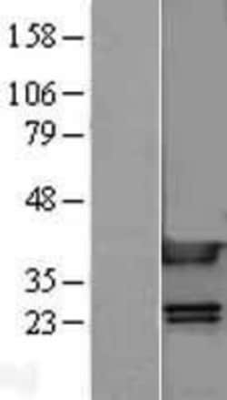 Novus Biologicals&trade;&nbsp;HMGB1/HMG-1 Overexpression Lysate