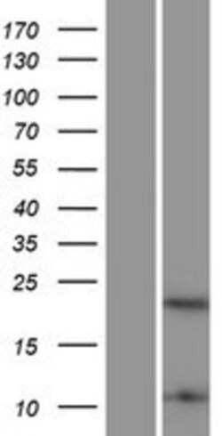 Novus Biologicals™ HMGB4 Overexpression Lysate