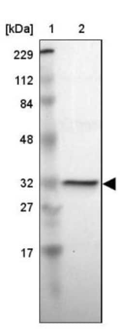 HMGCL Antibody, Novus Biologicals:Antibodies:Primary Antibodies