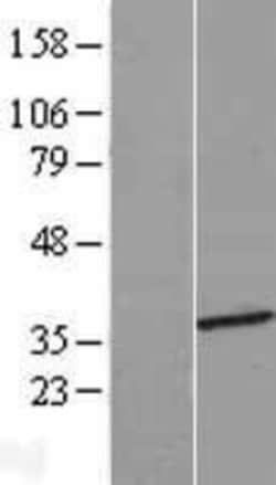 Novus Biologicals™ HMGCLL1 Overexpression Lysate