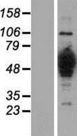 Novus Biologicals&trade;&nbsp;HMGCS1 Overexpression Lysate