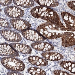 HMGCS1 Antibody, Novus Biologicals 0.1mL; Unlabeled:Anticuerpos