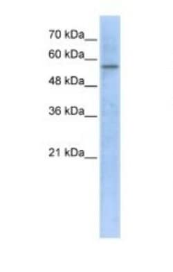 HMGCS1 Antibody, Novus Biologicals 0.05mg; Unlabeled:Antibodies, Polyclonal