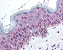 HMGN1/HMG14, p Ser20, p Ser24 Antibody, Novus Biologicals 0.1mg; Unlabeled:Antibodies,