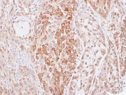 HMW Kininogen Antibody, Novus Biologicals 0.1mg; Unlabeled:Antibodies,
