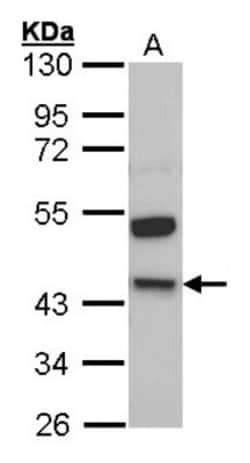 HMW Kininogen Antibody, Novus Biologicals 0.1mg; Unlabeled:Antibodies,