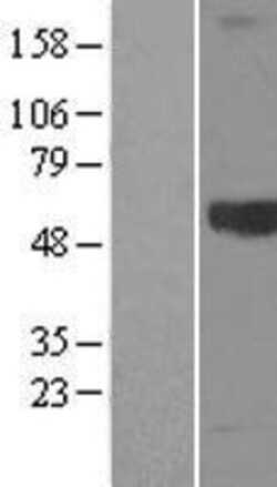 Novus Biologicals&trade;&nbsp;Kininogen Overexpression Lysate