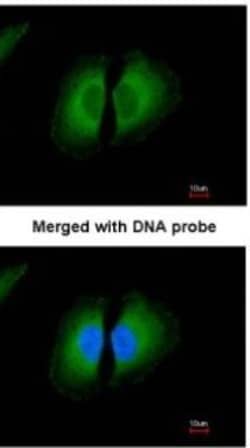 HMW Kininogen Antibody, Novus Biologicals 0.1mg; Unlabeled:Antibodies,