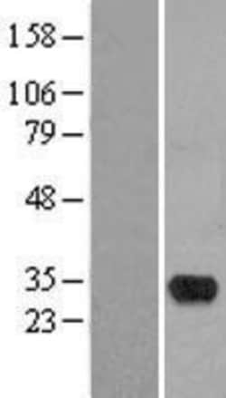 Novus Biologicals&trade;&nbsp;HMX2 Overexpression Lysate