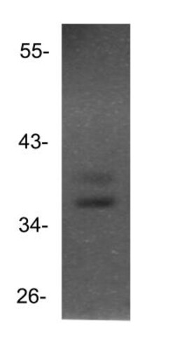 HMX3 Antibody, Novus Biologicals 100 &mu;L | Buy Online | Novus Biologicals | Fisher Scientific