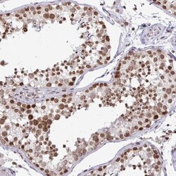 HN1 Antibody, Novus Biologicals 0.1mL; Unlabeled:Antibodies, Polyclonal