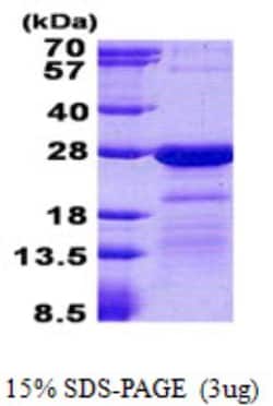 Novus Biologicals&trade;&nbsp;Recombinant Human HN1L His Protein