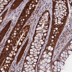 HN1L Antibody, Novus Biologicals:Antibodies:Primary Antibodies
