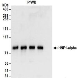 HNF1 Antibody, Novus Biologicals 0.1mg; Unlabeled:Antibodies, Polyclonal