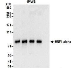 HNF1 Antibody, Novus Biologicals 0.1mg; Unlabeled:Antibodies, Polyclonal