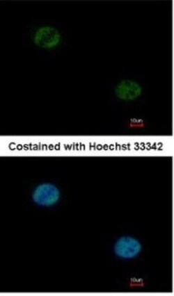 HNF-3 alpha/FoxA1 Antibody, Novus Biologicals 0.1mg; Unlabeled:Antibodies,