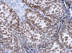 HNF-3 alpha/FoxA1 Antibody, Novus Biologicals 0.1mg; Unlabeled:Antibodies,