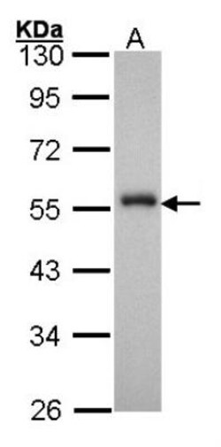 HNF-3 alpha/FoxA1 Antibody, Novus Biologicals 0.1mg; Unlabeled:Antibodies,