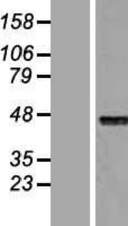 Novus Biologicals&trade;&nbsp;HNF-4 alpha/NR2A1 Overexpression Lysate