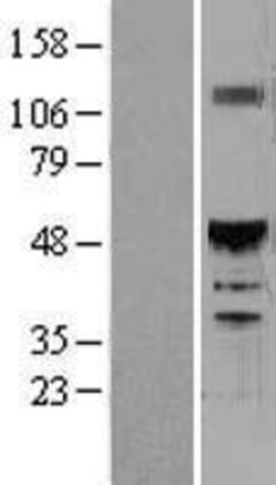 Novus Biologicals&trade;&nbsp;HNF-6/ONECUT1 Overexpression Lysate