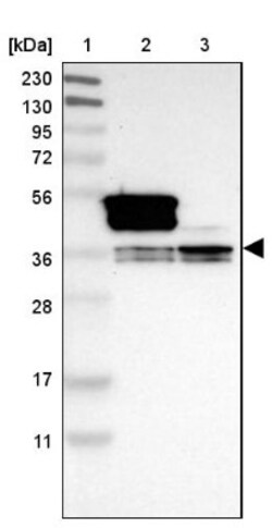 hnRNP A1 Antibody, Novus Biologicals:Antibodies:Primary Antibodies