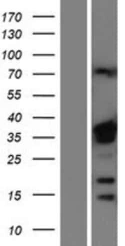 Novus Biologicals&trade;&nbsp;hnRNP A1 Overexpression Lysate