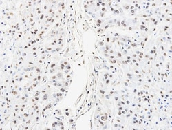 hnRNP AB Antibody, Novus Biologicals 0.1mL; Unlabeled:Antibodies, Polyclonal