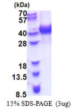 Novus Biologicals&trade;&nbsp;Recombinant Human hnRNP AB His Protein