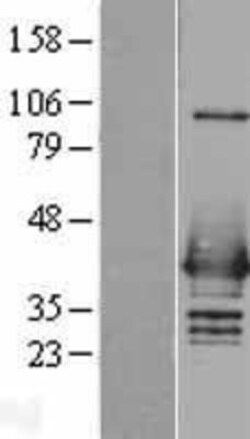 Novus Biologicals™ hnRNP C1 + C2 Overexpression Lysate