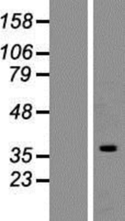 Novus Biologicals&trade;&nbsp;hnRNP C1 + C2 Overexpression Lysate