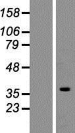 Novus Biologicals™ hnRNP C1 + C2 Overexpression Lysate