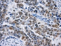 hnRNP F Antibody (OTI5F5), Novus Biologicals 0.1mL; Unlabeled:Antibodies,