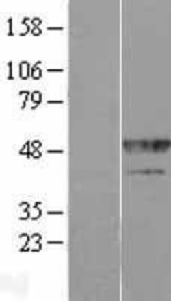 Novus Biologicals&trade;&nbsp;hnRNP F Overexpression Lysate