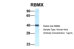 hnRNP G Antibody, Novus Biologicals 20&mu;L; Unlabeled:Antibodies, Polyclonal