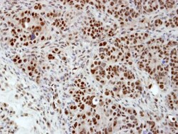 hnRNP H Antibody, Novus Biologicals 0.1mg; Unlabeled:Antibodies, Polyclonal