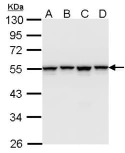 hnRNP H Antibody, Novus Biologicals 0.1mg; Unlabeled:Antibodies, Polyclonal