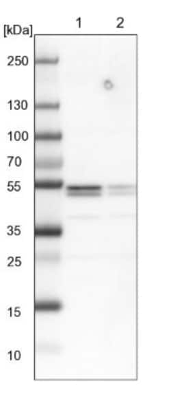 hnRNP H2 Antibody, Novus Biologicals 0.1mL; Unlabeled:Antibodies, Polyclonal