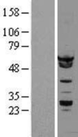 Novus Biologicals&trade;&nbsp;hnRNP K Overexpression Lysate