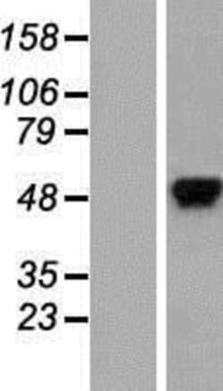 Novus Biologicals&trade;&nbsp;hnRNP K Overexpression Lysate