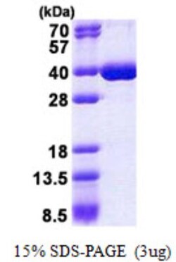 Novus Biologicals&trade;&nbsp;Recombinant Human hnRNP K His Protein