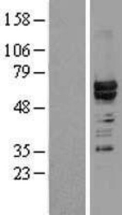 Novus Biologicals&trade;&nbsp;hnRNP L Overexpression Lysate