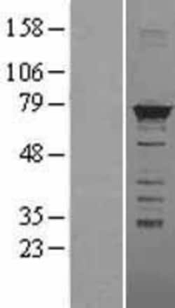 Novus Biologicals&trade;&nbsp;hnRNP M Overexpression Lysate