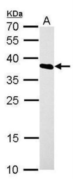 hnRNP A1 Antibody, Novus Biologicals 0.1mL; Unlabeled:Antibodies, Polyclonal