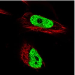 hnRNP C1 + C2 Antibody (CL2593), Novus Biologicals 0.1mL; Unlabeled:Antibodies,