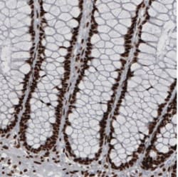 hnRNP C1 + C2 Antibody (CL2593), Novus Biologicals 0.1mL; Unlabeled:Antibodies,