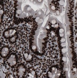 hnRNP C1 + C2 Antibody (CL2593), Novus Biologicals 0.1mL; Unlabeled:Antibodies,