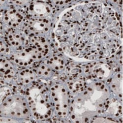 hnRNP C1 + C2 Antibody (CL2593), Novus Biologicals 0.1mL; Unlabeled:Antibodies,