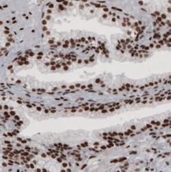 hnRNP C1 + C2 Antibody (CL2593), Novus Biologicals 0.1mL; Unlabeled:Antibodies,