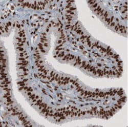 hnRNP C1 + C2 Antibody (CL2593), Novus Biologicals 0.1mL; Unlabeled:Antibodies,